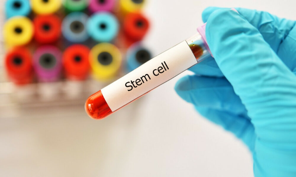 the-benefits-of-stem-cell-therapy-in-dubai:-anti-aging-and-regenerative-medicine-at-aeon-clinic